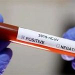 coronaviurus test positive